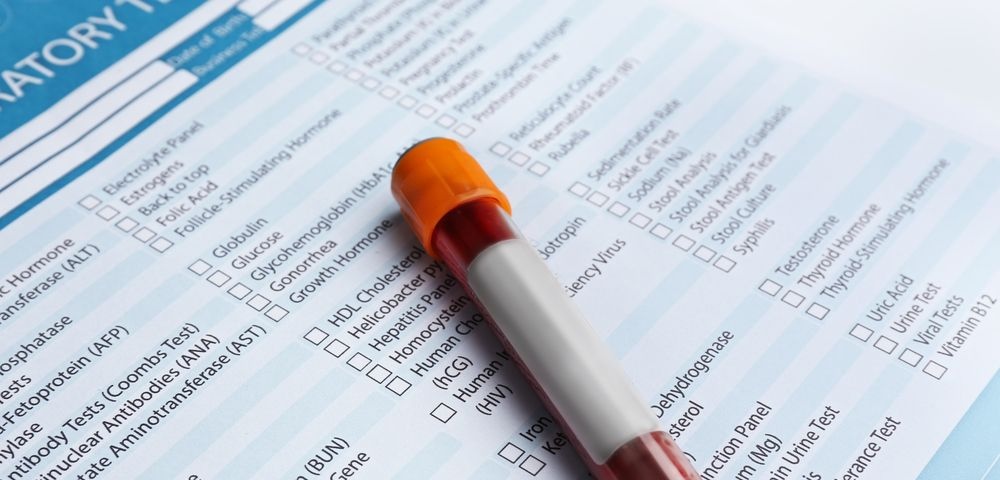 Кому необходим анализ на билирубин