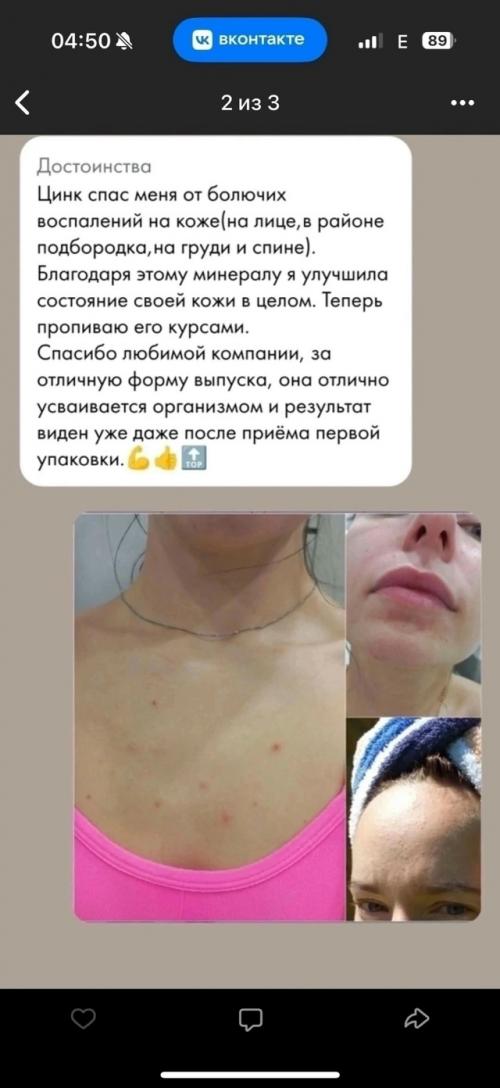 Цинк от NL - 7 причин начать принимать цинк каждой девушке. 02