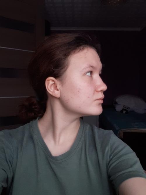 От_подписчицы@Normalnudesface. 02 От_подписчицы@Normalnudesface. 02