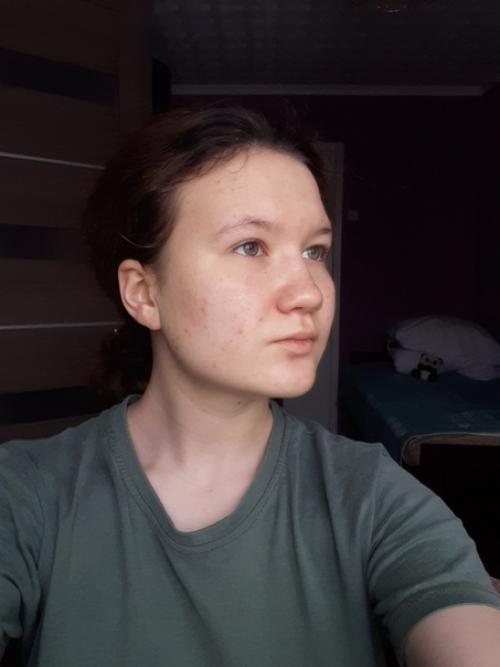 От_подписчицы@Normalnudesface. 01 От_подписчицы@Normalnudesface. 01