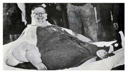 Джон миннок - это самый тяжелый человек в истории медицины. 02 Джон миннок - это самый тяжелый человек в истории медицины. 02