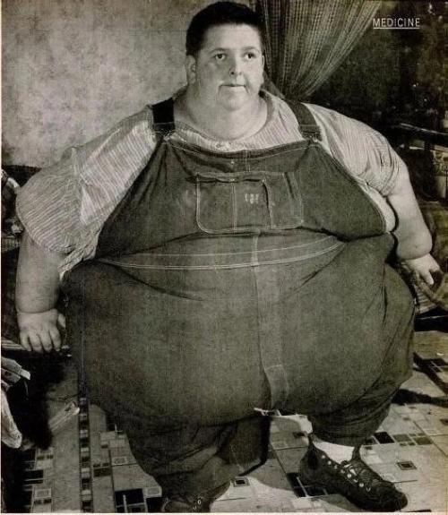 Джон миннок - это самый тяжелый человек в истории медицины. 01 Джон миннок - это самый тяжелый человек в истории медицины. 01