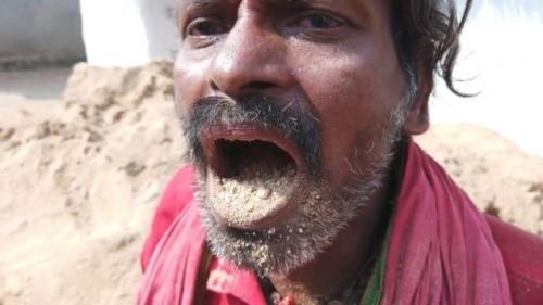 Рао из деревни каласападу, Индия, съедает минимум килограмм земли каждый день. 01