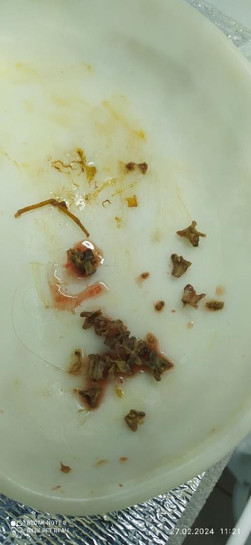 Давно не делала сложных операций! 05 Давно не делала сложных операций! 05