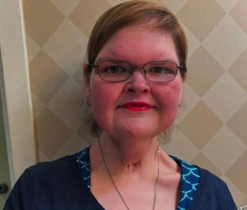 Очень сильно похудела. 02