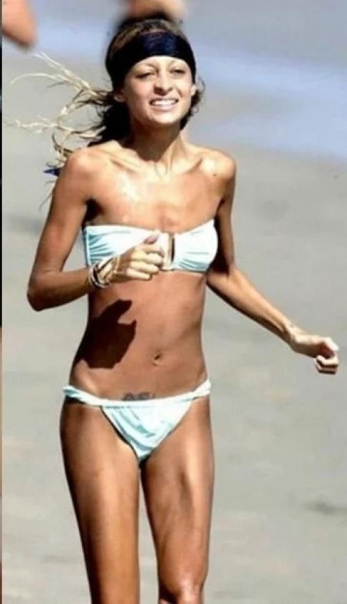 Знаменитости, которые похудев стали выглядеть просто ужасно. 01