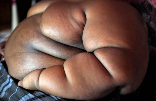 В Индонезии живет самый толстый мальчик в мире - в свои 10 лет он ест 5 раз в день и весит 192 кг. 02