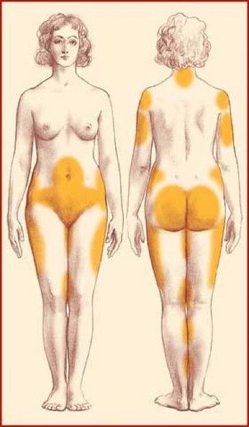 Антицеллюлитный баночный массаж - просто и эффективно! 01