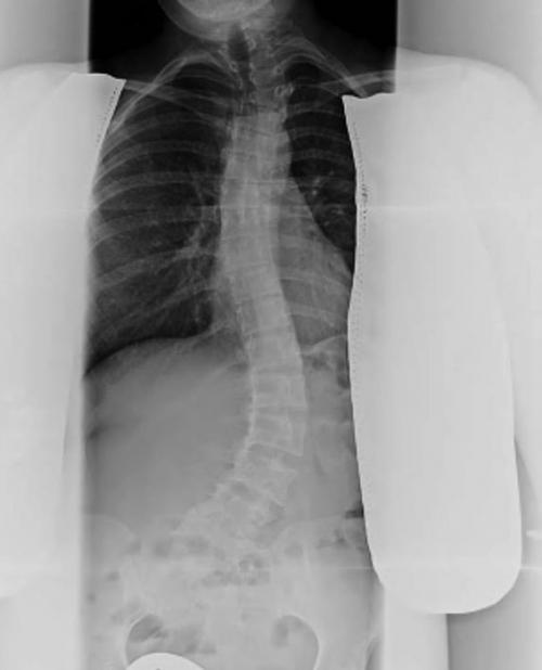 Хруст в плечевом суставе при поднятии руки. Народные советы 05 Хруст в плечевом суставе при поднятии руки. Народные советы 05