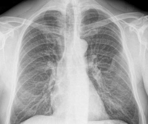 Хруст в плечевом суставе при поднятии руки. Народные советы 06 Хруст в плечевом суставе при поднятии руки. Народные советы 06