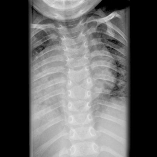 Хруст в плечевом суставе при поднятии руки. Народные советы 08 Хруст в плечевом суставе при поднятии руки. Народные советы 08