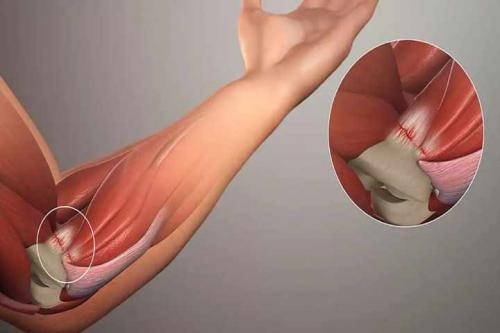 Немеет левая рука у мужчины. Почему немеет левая рука, кисть и пальцы: возможные диагнозы