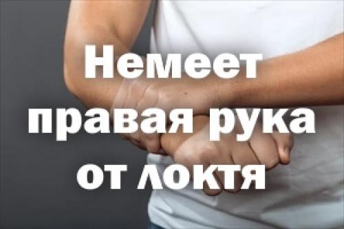 Немеет правая рука к какому врачу обратиться. Немеет правая рука от локтя