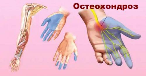 Немеет левая рука у мужчины. Почему немеет левая рука, кисть и пальцы: возможные диагнозы