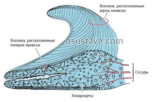 Сколько менисков в коленях. Что такое мениск коленного сустава, возможные повреждения, их причины и лечение