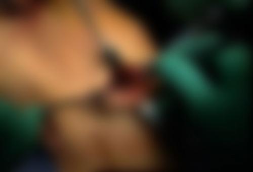 Жизнь после удаления мениска. Техника полного и частичного удаления мениска, эффективность операции, осложнения