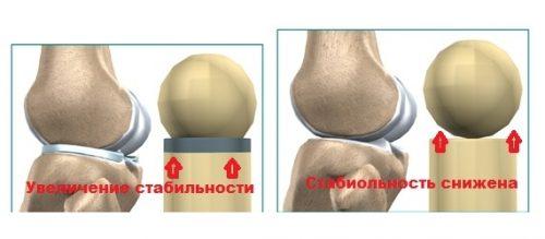 Сколько менисков в коленном суставе. Строение и функции мениска