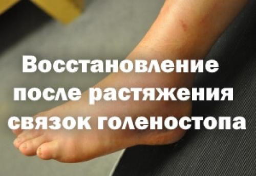 Растяжение связок голеностопного сустава срок восстановления. Восстановление после растяжения связок голеностопа