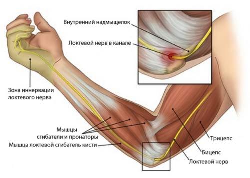 Боль в локтевом суставе с внутренней стороны. Возможные заболевания