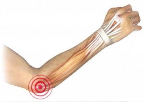 Болит локоть при полном разгибании. Основные причины