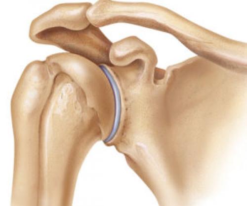 Хрустит плечевой сустав и болит. Плечевой сустав болит и хрустит 10