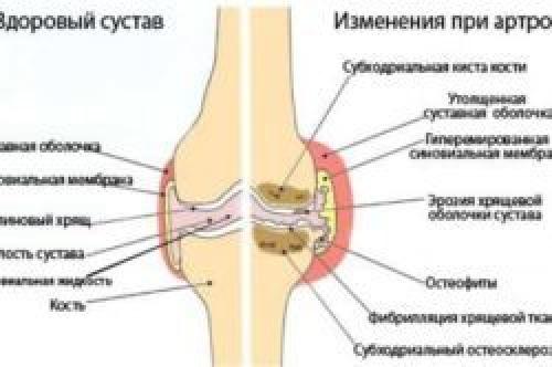 Заболевания подвздошной кишки симптомы и признаки болезни. Симптомы болезней подвздошной кишки и их причины