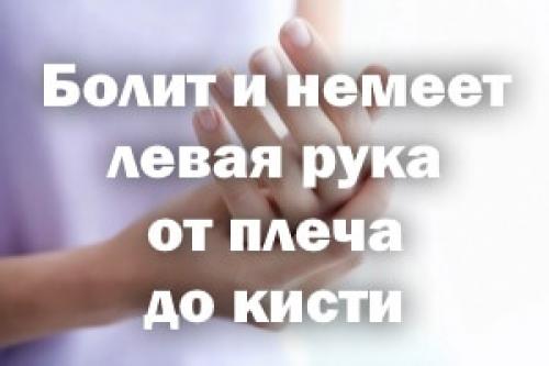 Болит запястье и немеет рука. Болит и немеет левая рука от плеча до кисти