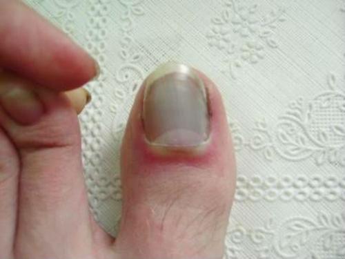 Строение человеческого пальца. Строение 01 Строение человеческого пальца. Строение 01