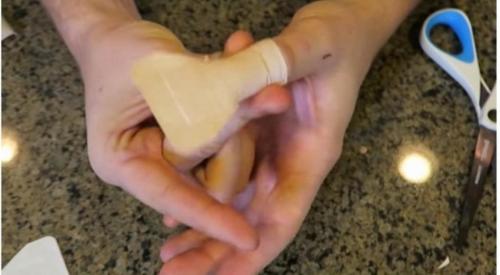 Как клеить пластырь. Как приклеить лейкопластырь на палец, чтобы он не сползал: простой способ, о котором самому не догадаться 13