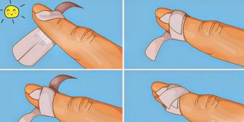 Как клеить пластырь. Как приклеить лейкопластырь на палец, чтобы он не сползал: простой способ, о котором самому не догадаться 10