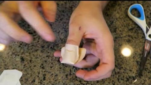 Как клеить пластырь. Как приклеить лейкопластырь на палец, чтобы он не сползал: простой способ, о котором самому не догадаться 14