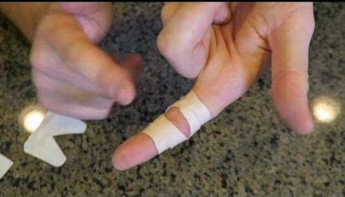 Как клеить пластырь. Как приклеить лейкопластырь на палец, чтобы он не сползал: простой способ, о котором самому не догадаться 08