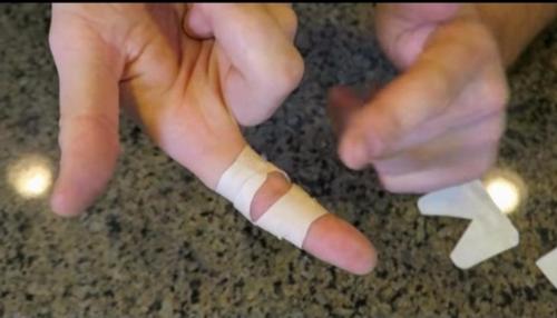 Как клеить пластырь. Как приклеить лейкопластырь на палец, чтобы он не сползал: простой способ, о котором самому не догадаться 17