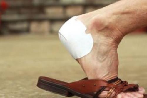 Как клеить пластырь на пятку. Какой пластырь выбрать для лечения пяточной шпоры