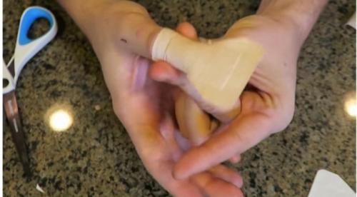 Как клеить пластырь. Как приклеить лейкопластырь на палец, чтобы он не сползал: простой способ, о котором самому не догадаться 03