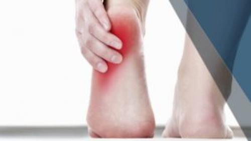 Как клеить пластырь на пятку. Какой пластырь выбрать для лечения пяточной шпоры