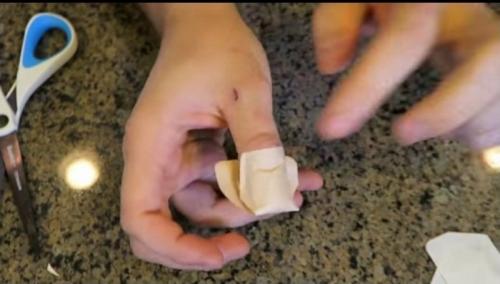 Как клеить пластырь. Как приклеить лейкопластырь на палец, чтобы он не сползал: простой способ, о котором самому не догадаться 04