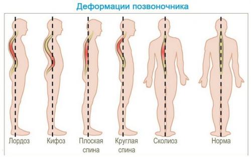 Как определить болит сустав или мышца. Почему могут болеть суставы и мышцы