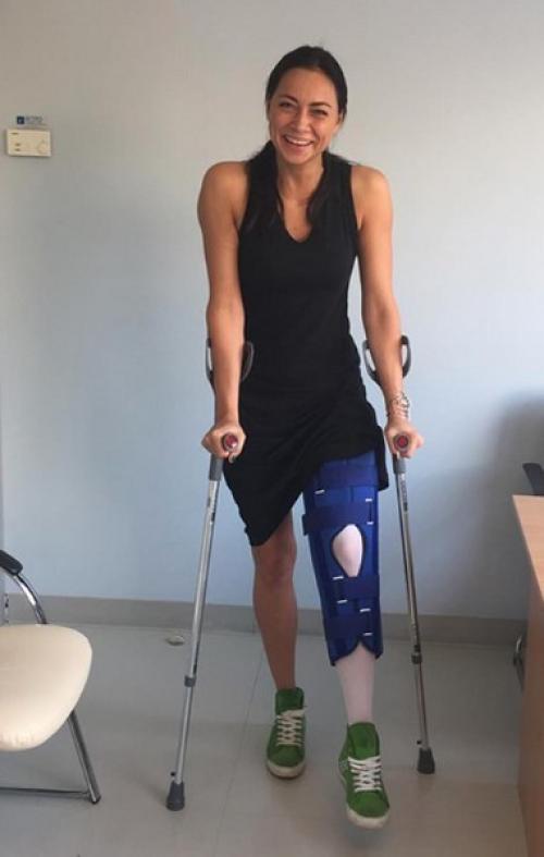 Как долго восстанавливаются связки колена. Разрыв крестообразной связки колена — сроки восстановления и реабилитация после операции (пластики)