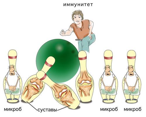 Артрит пальцев рук лечение форум. Как вылечить артрит суставов пальцев рук?
