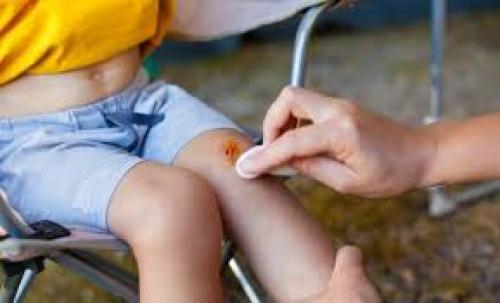 Арника крем турция. Как использовать мазь Арника