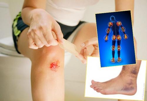 Арника крем-гель. Мазь «Арника»: инструкция по применению, показания