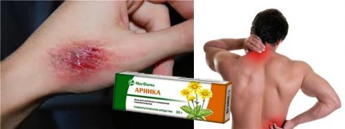 Арника крем-гель. Мазь «Арника»: инструкция по применению, показания