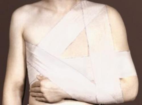 Перевязка плеча бинтом. Какая перевязка при переломе плеча более эффективна