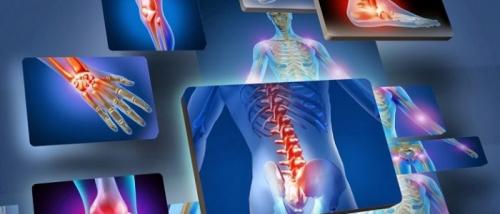 Как вывести соли из суставов ног. Как избавиться от солей в суставах?