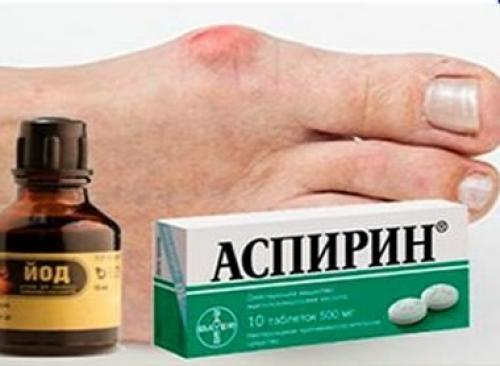 Шишка на пальце ноги лечение мазь. Лечение поваренной и морской солью