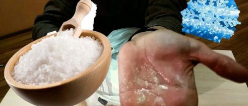 Снег и соль для лечения суставов. Соль со снегом для лечения суставов