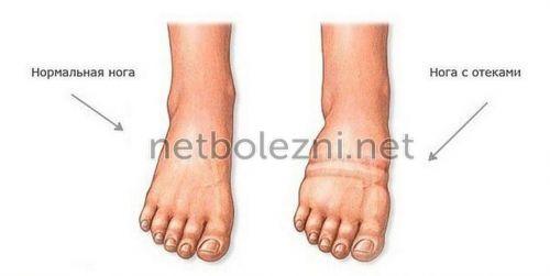 Для суставов и связок народные средства. Упражнения 07 Для суставов и связок народные средства. Упражнения 07