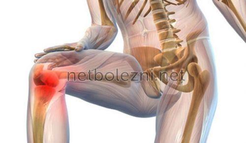 Для суставов и связок народные средства. Упражнения 04 Для суставов и связок народные средства. Упражнения 04