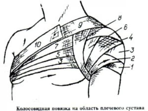 Повязка при переломе плеча. Какая перевязка при переломе плеча более эффективна